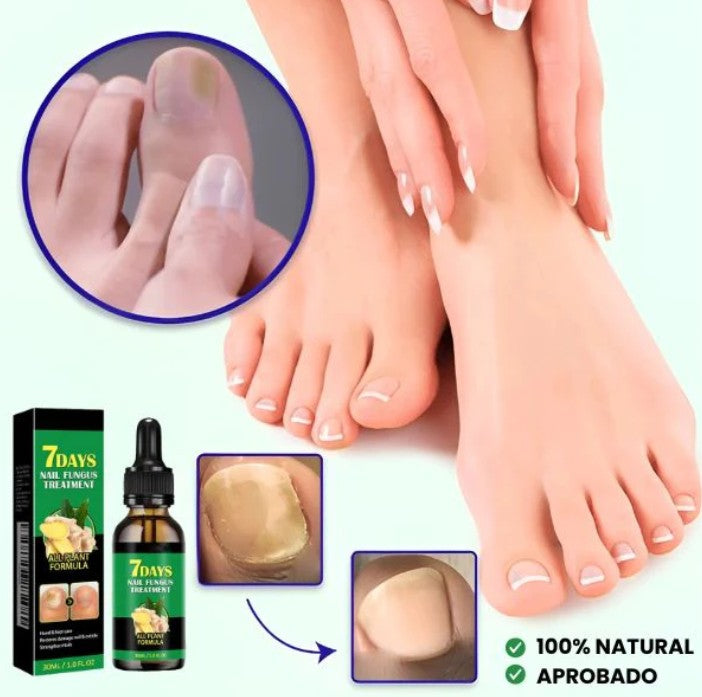 SUERO ANTI HONGOS 7 DIAS NAIL1