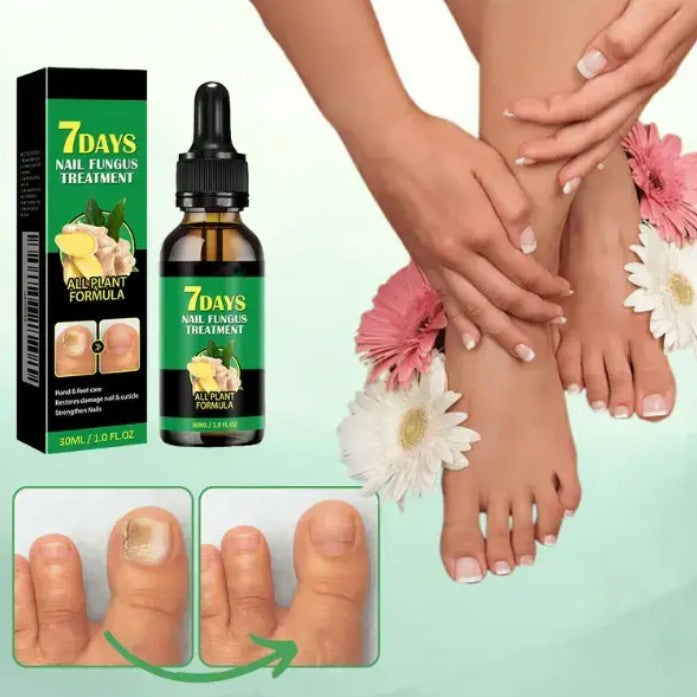 SUERO ANTI HONGOS 7 DIAS NAIL1