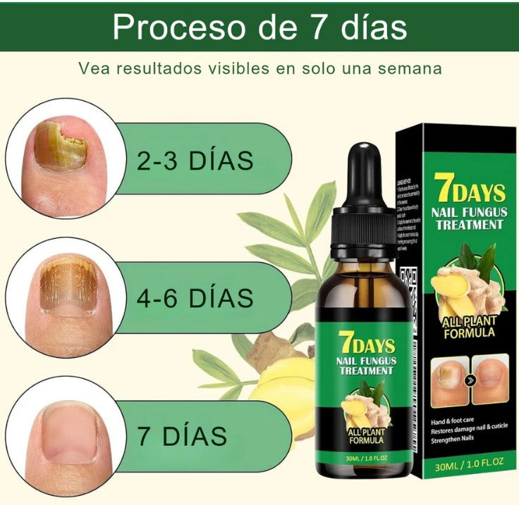 SUERO ANTI HONGOS 7 DIAS NAIL1