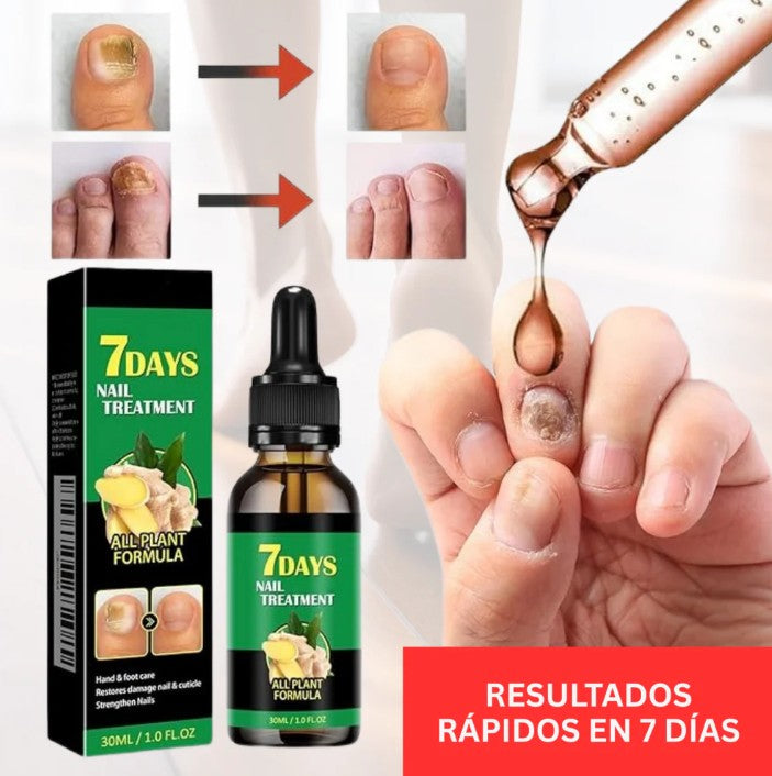 SUERO ANTI HONGOS 7 DIAS NAIL1